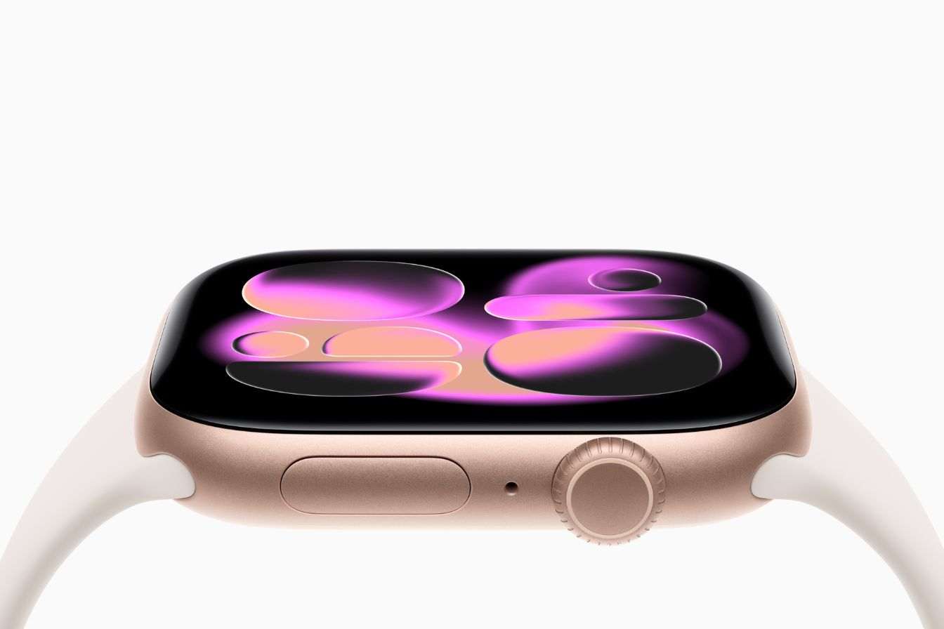 Apple Watch11